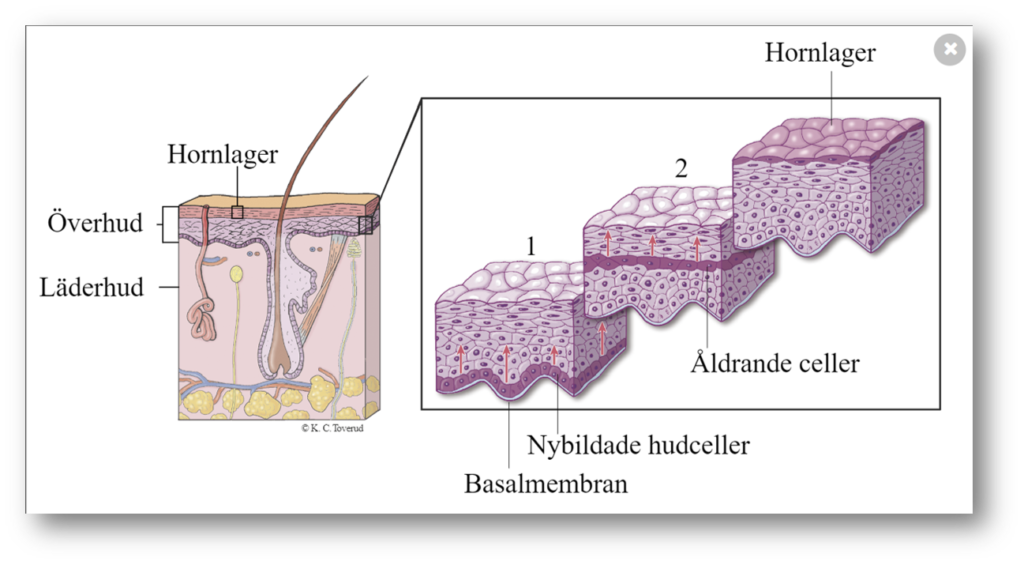 Med döda och gamla platta epitelceller har hornlager byggts.