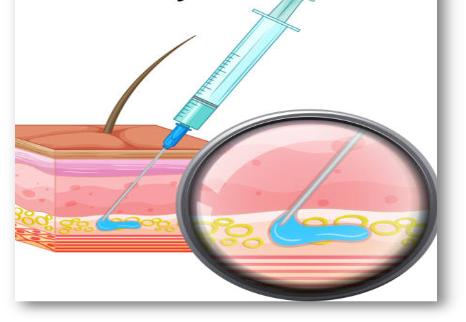 Jag har byggts under dermis - läderhuden, djupare ner i huden. Det har inte ritats någon tydlig gräns mellan mig och dermis - läderhuden. Jag har designats med bindväv och fettvävnad.